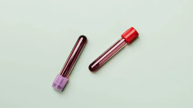 Recursos para estudiar Hematología y Hemoterapia