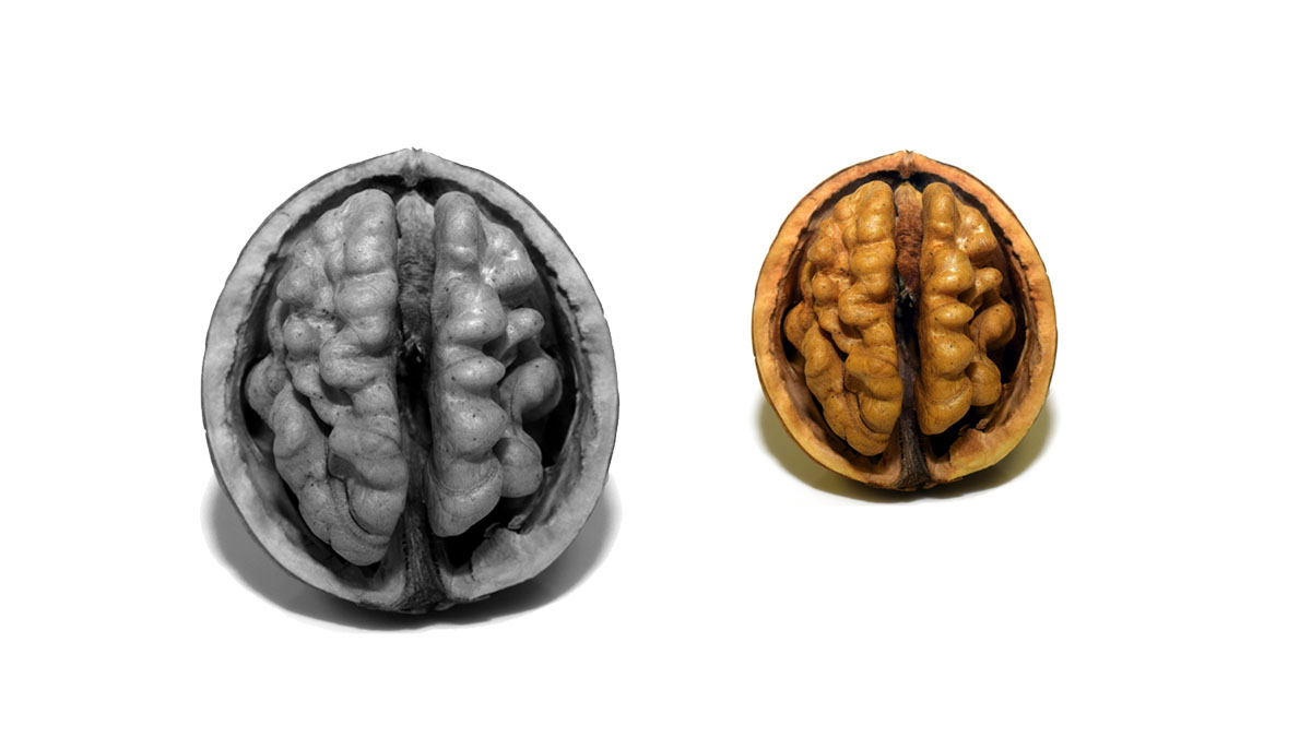 4 enfermedades del Sistema Nervioso: curiosidades, preguntas y películas